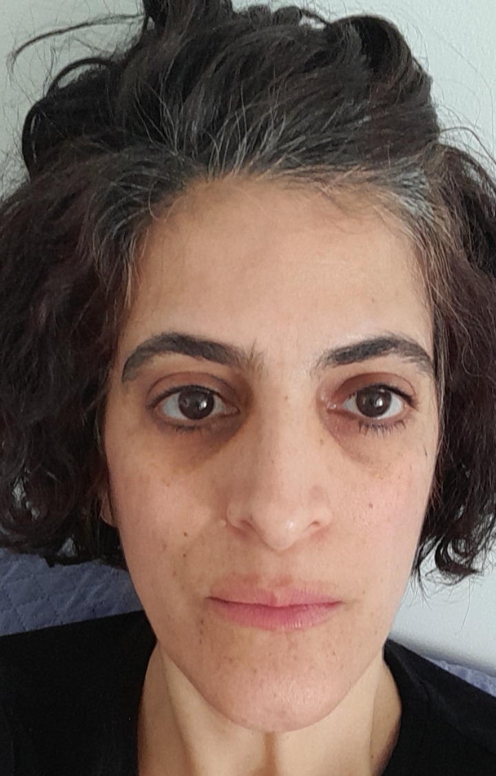 תמונת פנים
